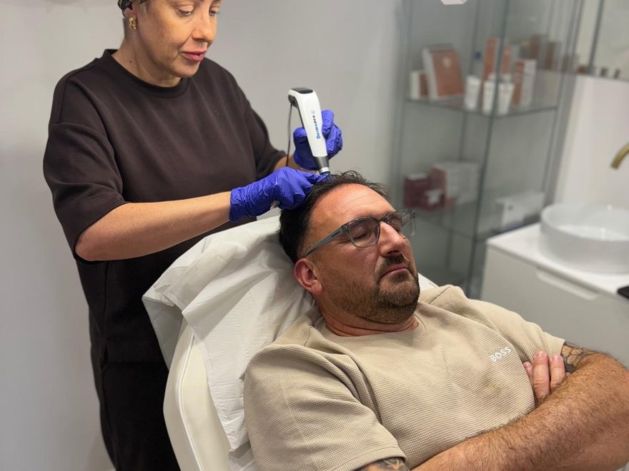 PRP hair restoration treatment by Abbie at her Basildon clinic