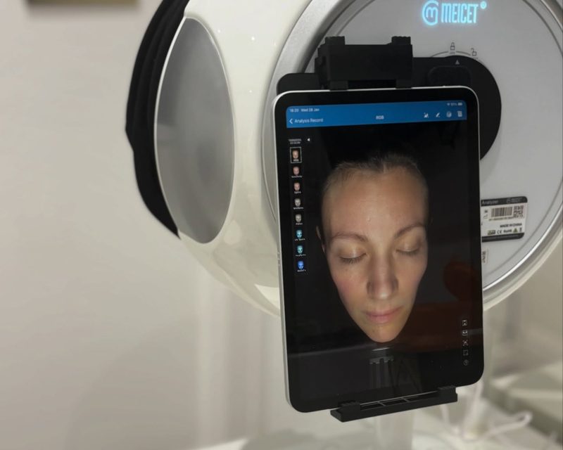 Skin analysis at AbbieJaine Aesthetics, Basildon